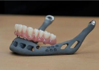 3D PRINTED Titanium JAW!